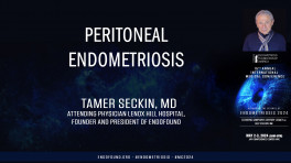 Peritoneal Endometriosis - Tamer Seckin, MD