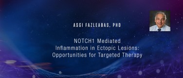 Asgi Fazleabas, PhD - NOTCH1 Mediated Inflammation in Ectopic Lesions: Opportunities for Targeted Therapy?