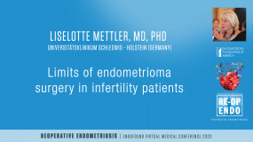 Limits of endometrioma surgery in infertility patients - Liselotte Mettler, MD, PhD?pop=mc