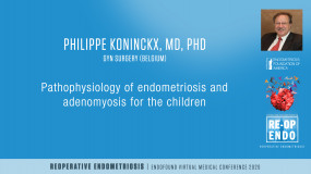Pathophysiology of endometriosis and adenomyosis for the clinician - Philippe Koninckx, MD, PhD?pop=on