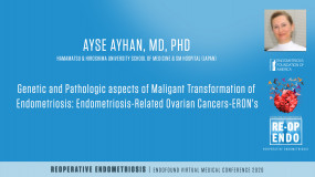 Genetic and Pathologic aspects of Maligant Transformation of Endometriosis: Endometriosis-Related Ovarian Cancers-ERON's - Ayse Ayhan, MD?pop=on
