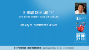 Peritoneal endometriosis and adenomyosis are molecularly related to eutopic endometrium? - Ie-Ming Shih, MD, PhD?pop=on