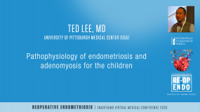 Laparoscopic Approach to Rectus Muscle Endometriosis and Inguinal Endometriosis - Ted Lee, MD?pop=mc
