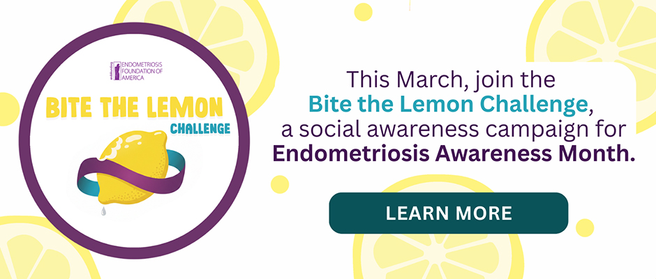 Bite the Lemon Challenge