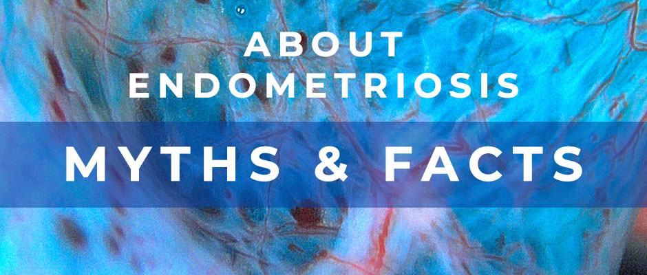 Endometriosis A-Z