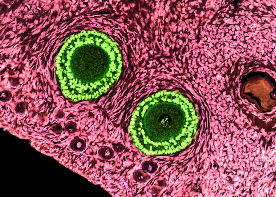 Ovary Magnified