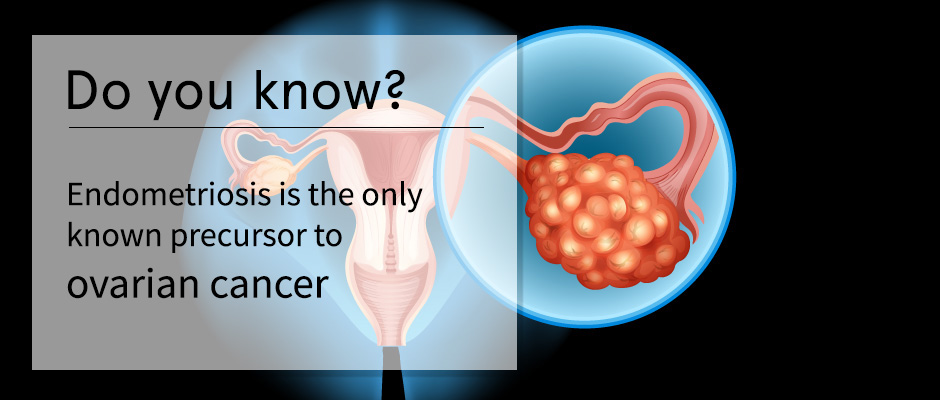 endometriosis medical term endometriosis medical term
