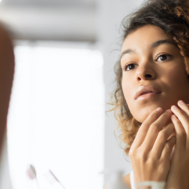 Battling Cystic Acne? You’re Not Alone. Here’s What You Need to Know if you’re an Endo Warrior